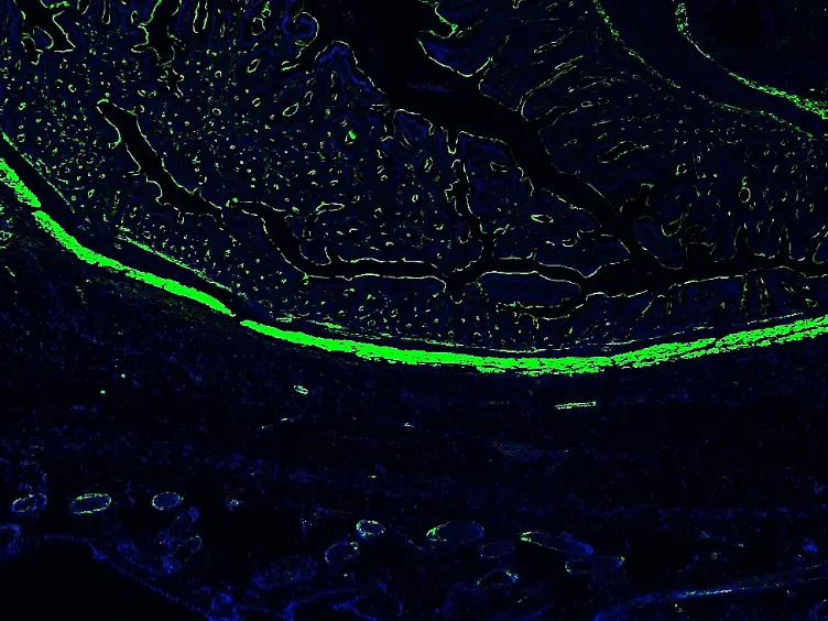Creation of Abdominal Adhesions in Mice