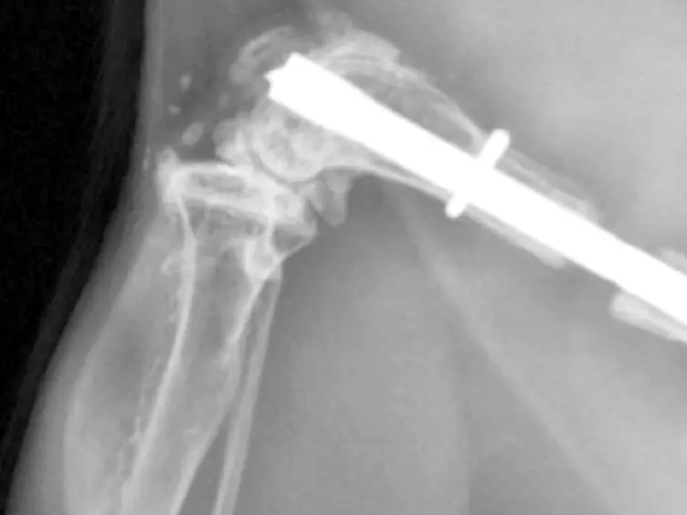 An Intramedullary Locking Nail for Standardized Fixation of Femur Osteotomies to Analyze Normal and Defective Bone Healing in Mice