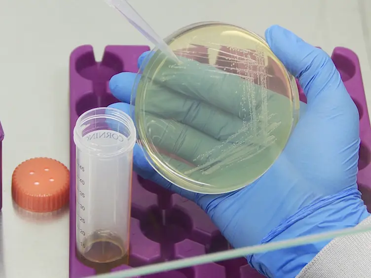Experimental Infection with <em>Listeria monocytogenes</em> as a Model for Studying Host Interferon-γ Responses