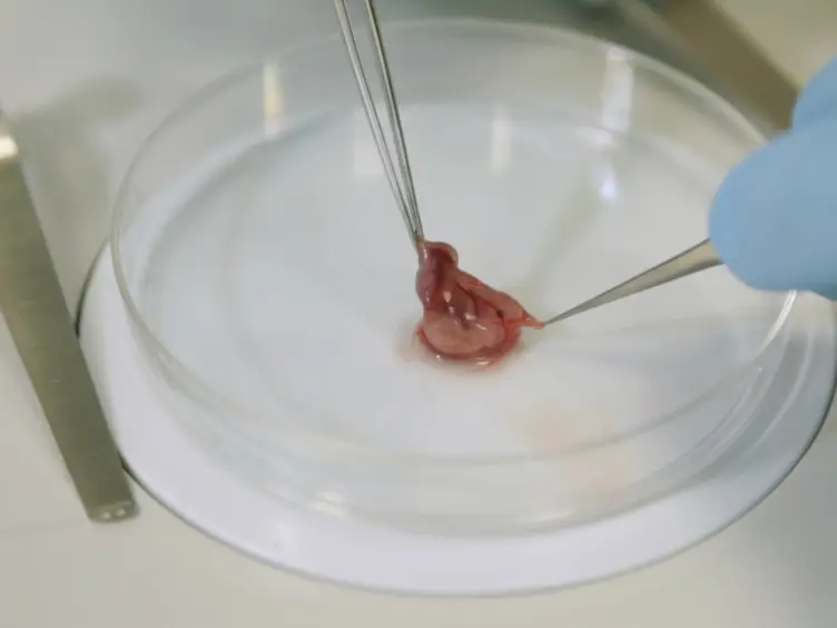 The Production of Pluripotent Stem Cells from Mouse Amniotic Fluid Cells Using a Transposon System