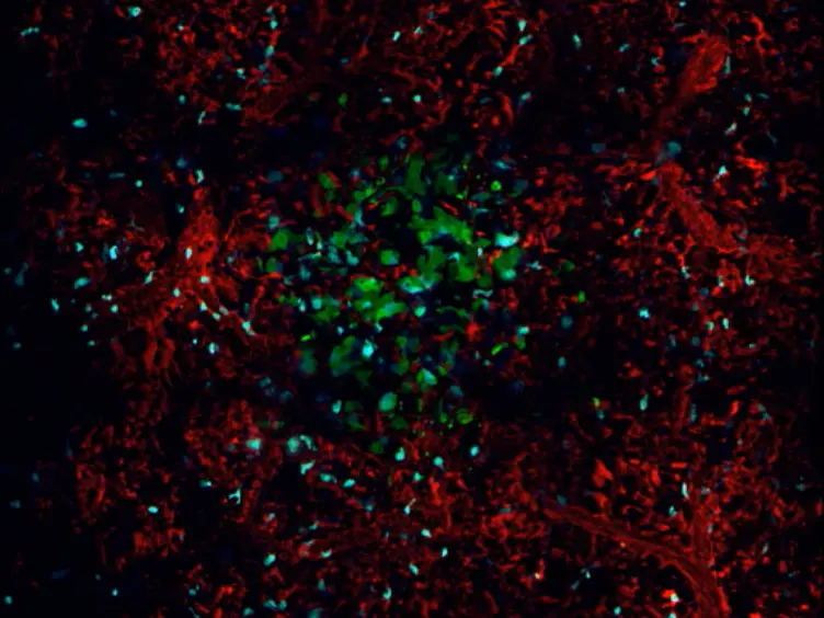 Long-term High-Resolution Intravital Microscopy in the Lung with a Vacuum Stabilized Imaging Window