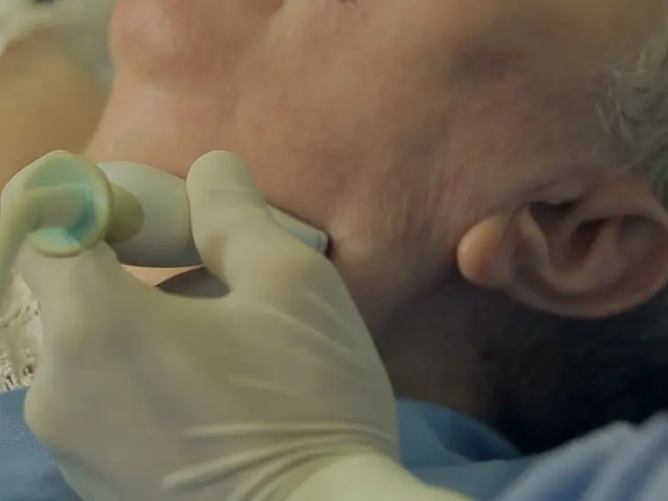 Ultrasound-guided Botulinum Toxin-A Injections: A Method of Treating Sialorrhea