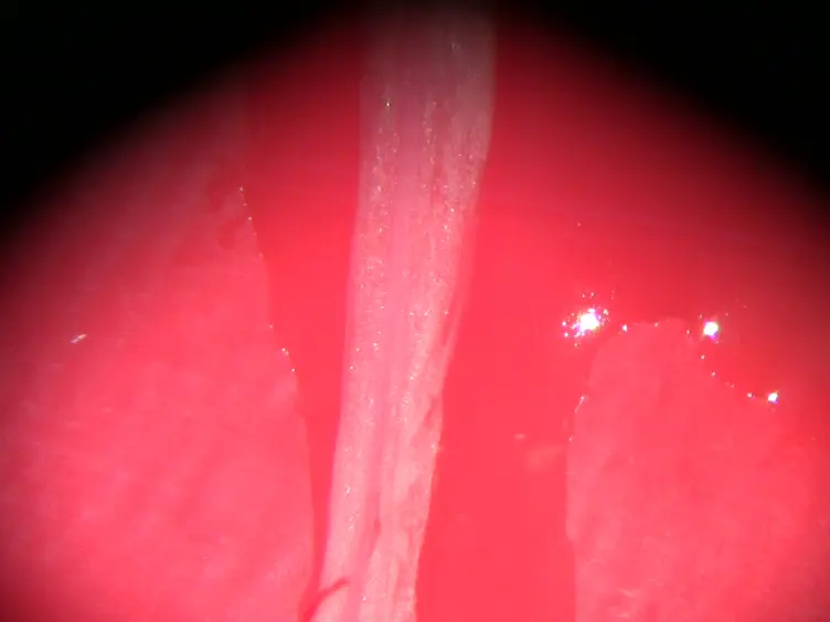 The Mouse Isolated Perfused Kidney Technique