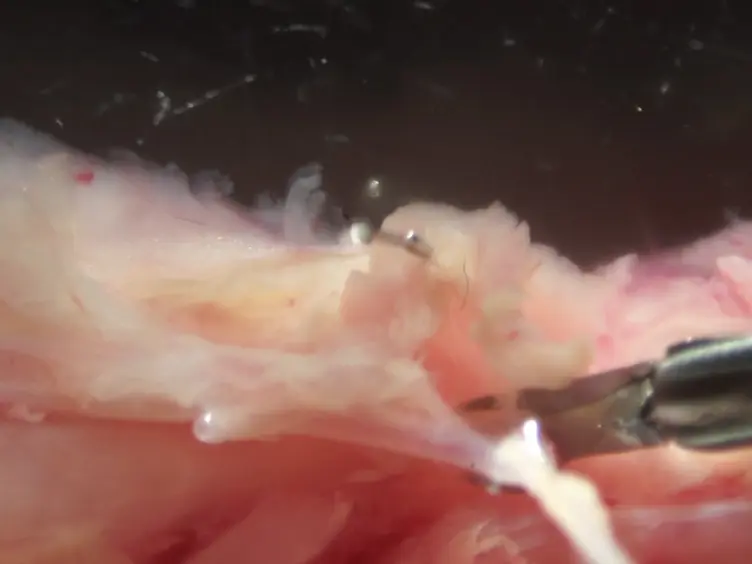 Reproducible Arterial Denudation Injury by Infrarenal Abdominal Aortic Clamping in a Murine Model