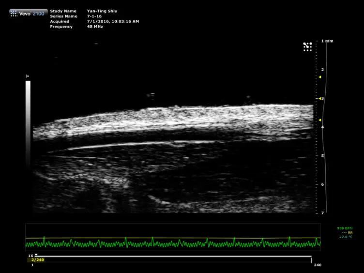 Ultrasound Assessment of Flow-Mediated Dilation of the Brachial and Superficial Femoral Arteries in Rats