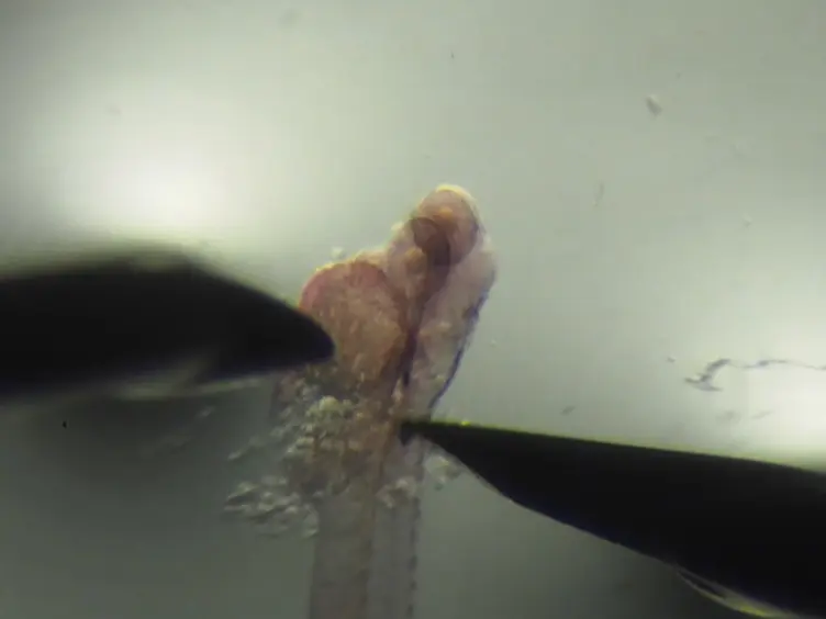 Visualizing the Interrenal Steroidogenic Tissue and Its Vascular Microenvironment in Zebrafish