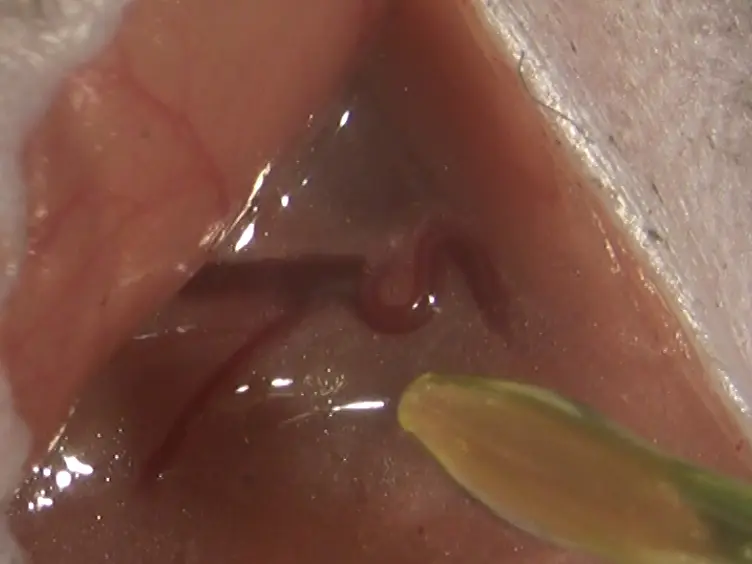 Combined Intravital Microscopy and Contrast-enhanced Ultrasonography of the Mouse Hindlimb to Study Insulin-induced Vasodilation and Muscle Perfusion