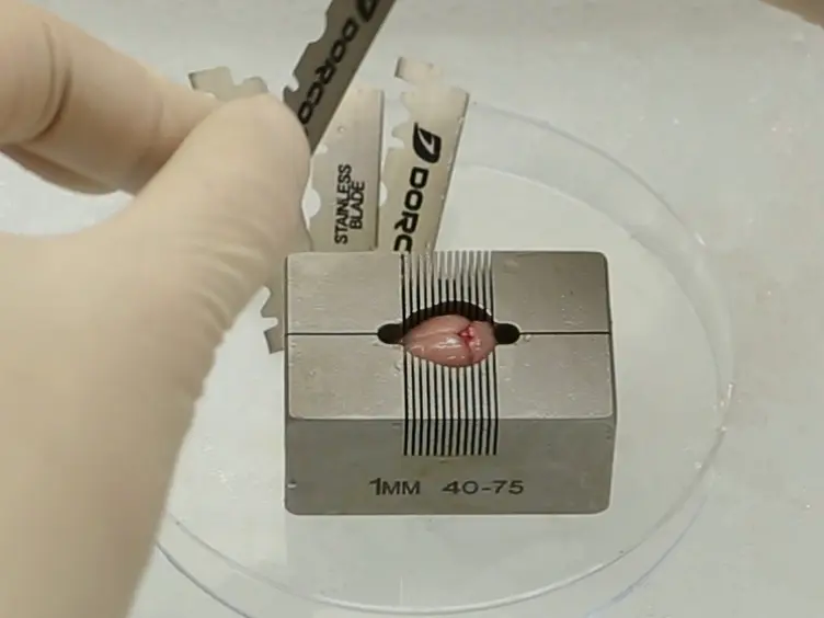 Isolation and Culture of Adult Neural Stem Cells from the Mouse Subcallosal Zone