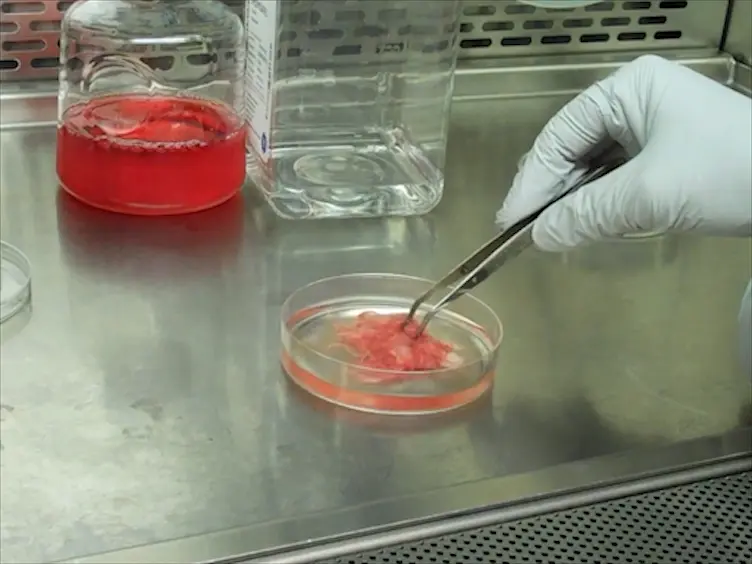 Derivation of Leptomeninges Explant Cultures from Postmortem Human Brain Donors