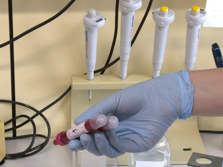 Isolation and Characterization of Microvesicles from Peripheral Blood