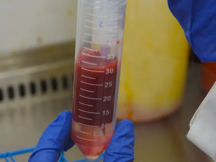 Generation of Integration-free Induced Pluripotent Stem Cells from Human Peripheral Blood Mononuclear Cells Using Episomal Vectors