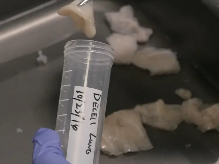 Tunable Hydrogels from Pulmonary Extracellular Matrix for 3D Cell Culture