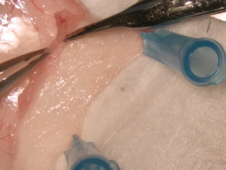 Murine Full-thickness Skin Transplantation