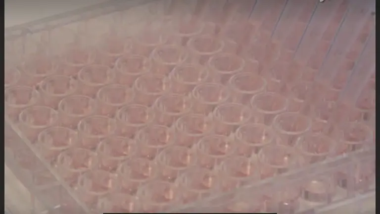 Forskolin-induced Swelling in Intestinal Organoids: An <em>In Vitro</em> Assay for Assessing Drug Response in Cystic Fibrosis Patients