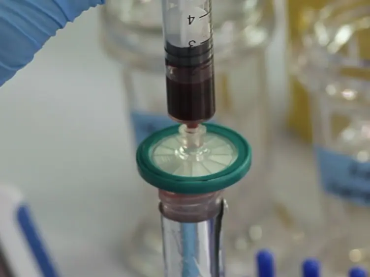 Optimized Analysis of <em>In Vivo</em> and <em>In Vitro</em> Hepatic Steatosis