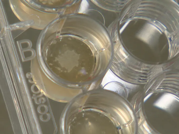 A Simple Red Blood Cell Lysis Method for the Establishment of B Lymphoblastoid Cell Lines