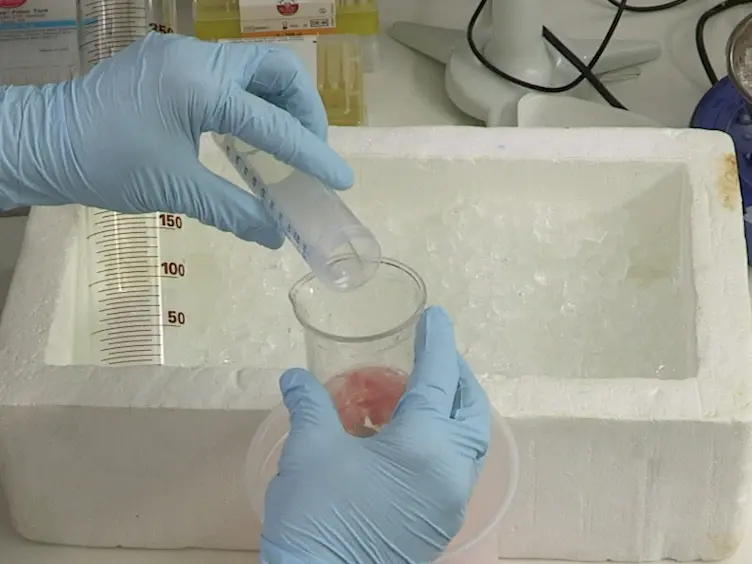 Isolation of Intact Mitochondria from Skeletal Muscle by Differential Centrifugation for High-resolution Respirometry Measurements