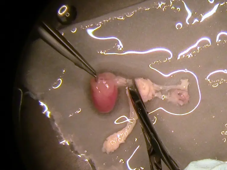 <em>En Face</em> Preparation of Mouse Blood Vessels