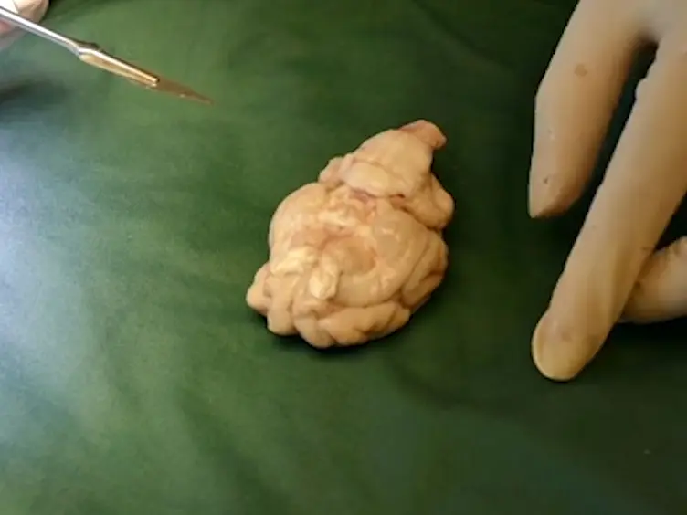 Exposure of the Pig CNS for Histological Analysis: A Manual for Decapitation, Skull Opening, and Brain Removal