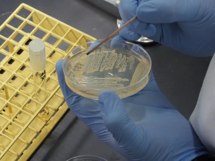 A Tandem Liquid Chromatography–Mass Spectrometry-based Approach for Metabolite Analysis of <em>Staphylococcus aureus</em>