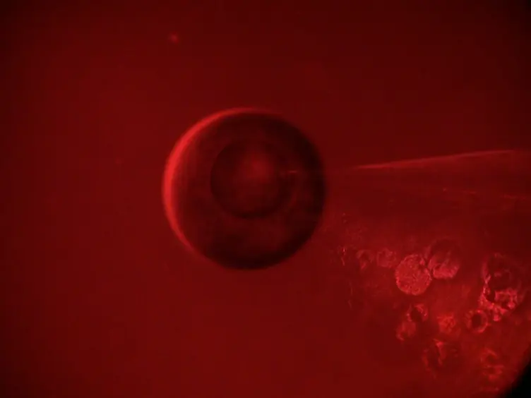 Voltage-clamp Fluorometry in <em>Xenopus</em> Oocytes Using Fluorescent Unnatural Amino Acids