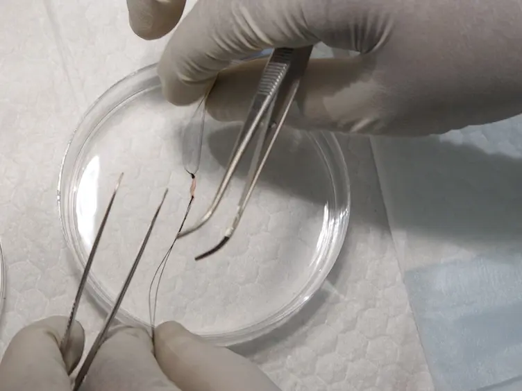 Minimally Invasive Muscle Embedding (MIME) - A Novel Experimental Technique to Facilitate Donor-Cell-Mediated Myogenesis