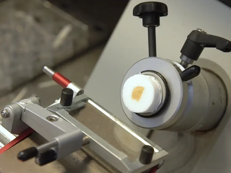 The Optical Fractionator Technique to Estimate Cell Numbers in a Rat Model of Electroconvulsive Therapy