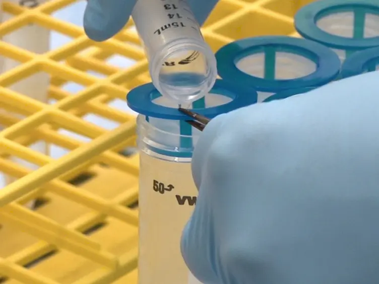 Detecting Estrogenic Ligands in Personal Care Products using a Yeast Estrogen Screen Optimized for the Undergraduate Teaching Laboratory