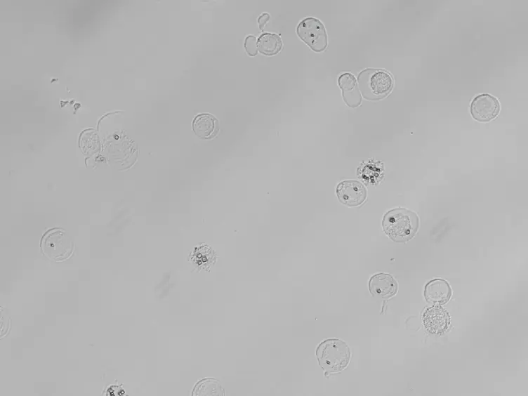 Microcrystallography of Protein Crystals and <em>In Cellulo</em> Diffraction