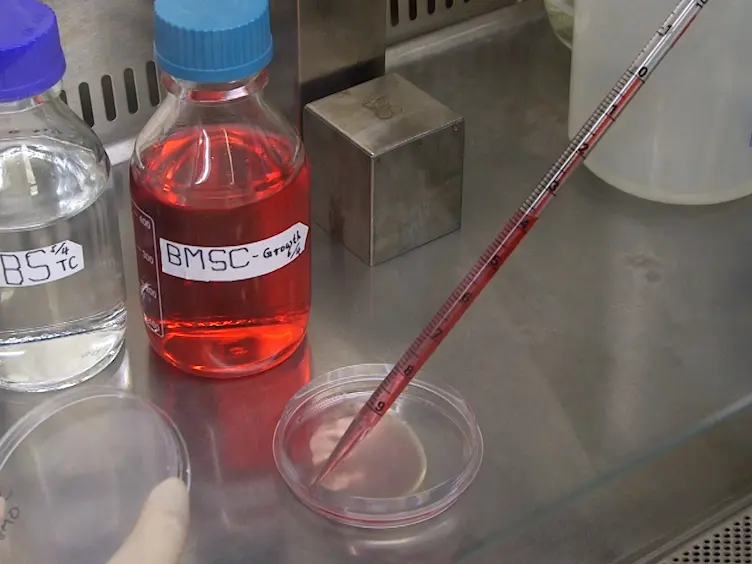 Hypoxic Preconditioning of Marrow-derived Progenitor Cells As a Source for the Generation of Mature Schwann Cells
