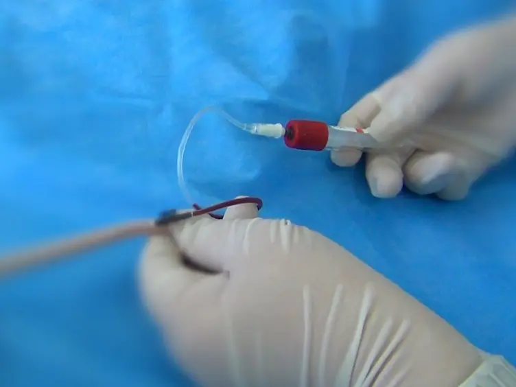 Repeated Blood Collection from Tail Vein of Non-Anesthetized Rats with a Vacuum Blood Collection System