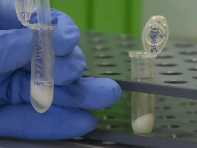 Chromatin Immunoprecipitation (ChIP) in Mouse T-cell Lines