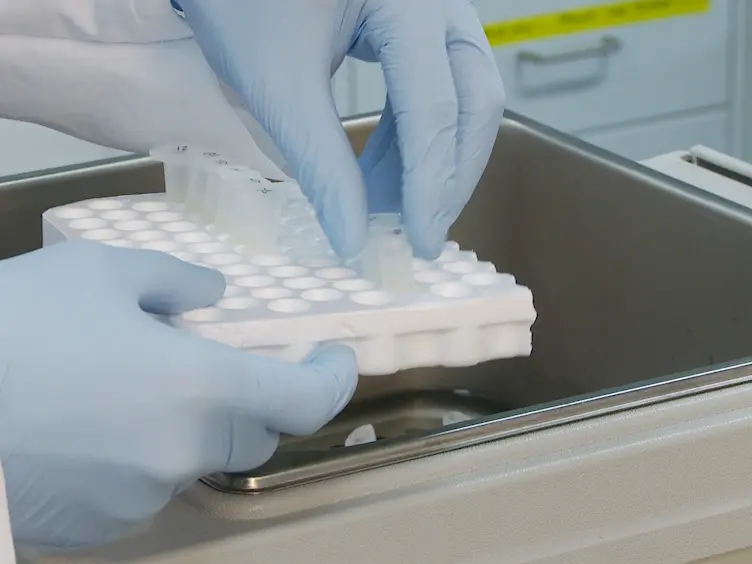 Peptide and Protein Quantification Using Automated Immuno-MALDI (iMALDI)