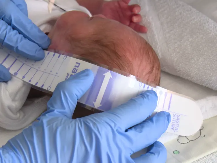 Application of an Amplitude-integrated EEG Monitor (Cerebral Function Monitor) to Neonates