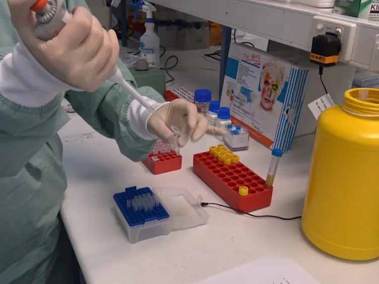 Optimized LC-MS/MS Method for the High-throughput Analysis of Clinical Samples of Ivacaftor, Its Major Metabolites, and Lumacaftor in Biological Fluids of Cystic Fibrosis Patients