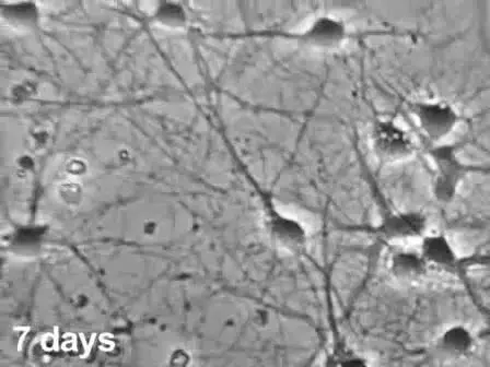 Preparation of Dissociated Mouse Cortical Neuron Cultures