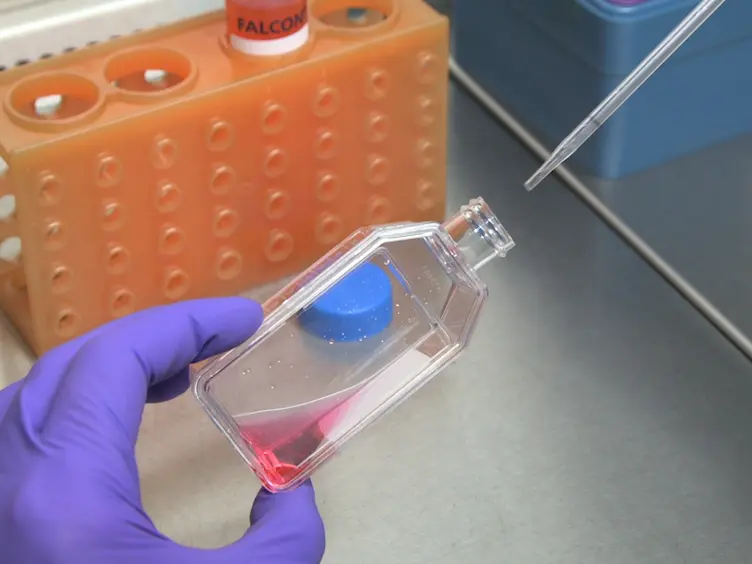 Evaluation of the Cell Invasion and Migration Process: A Comparison of the Video Microscope-based Scratch Wound Assay and the Boyden Chamber Assay