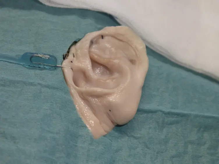 Discovering Middle Ear Anatomy by Transcanal Endoscopic Ear Surgery: A Dissection Manual