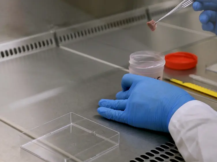 Establishment of a Primary Culture of Patient-derived Soft Tissue Sarcoma