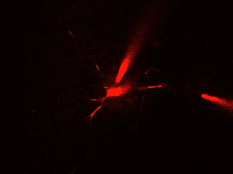 Two-photon Calcium Imaging in Neuronal Dendrites in Brain Slices