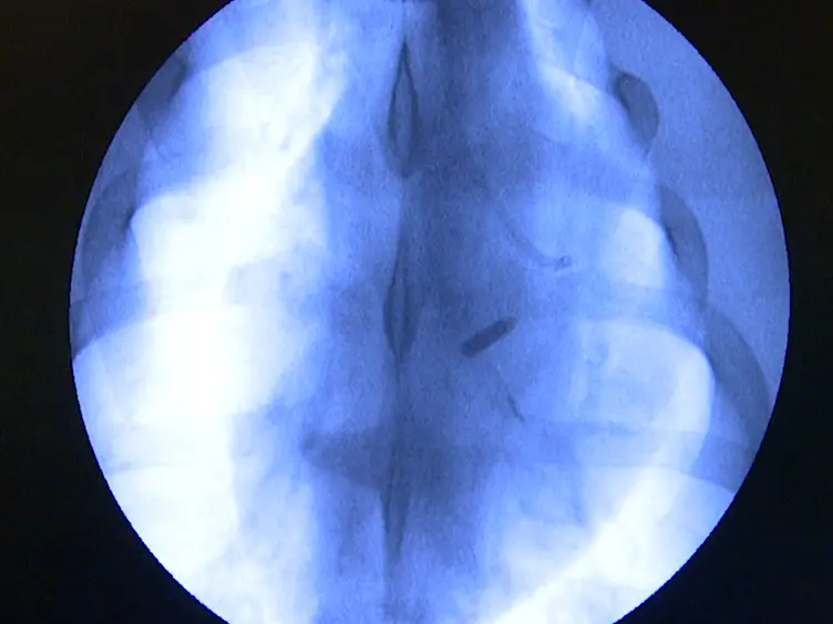Improvement of a Closed Chest Porcine Myocardial Infarction Model by Standardization of Tissue and Blood Sampling Procedures