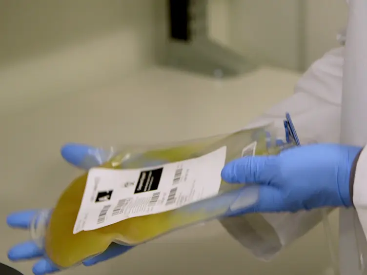 Routine Screening Method for Microparticles in Platelet Transfusions