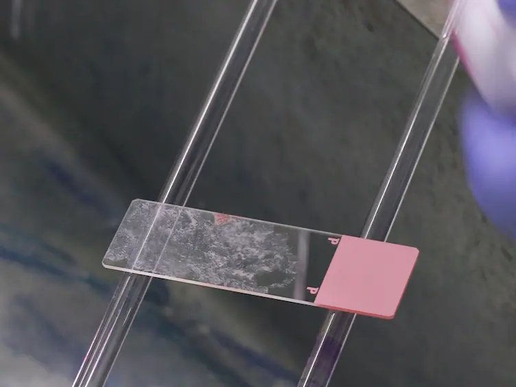 Simple and Rapid Method to Obtain High-quality Tumor DNA from Clinical-pathological Specimens Using Touch Imprint Cytology