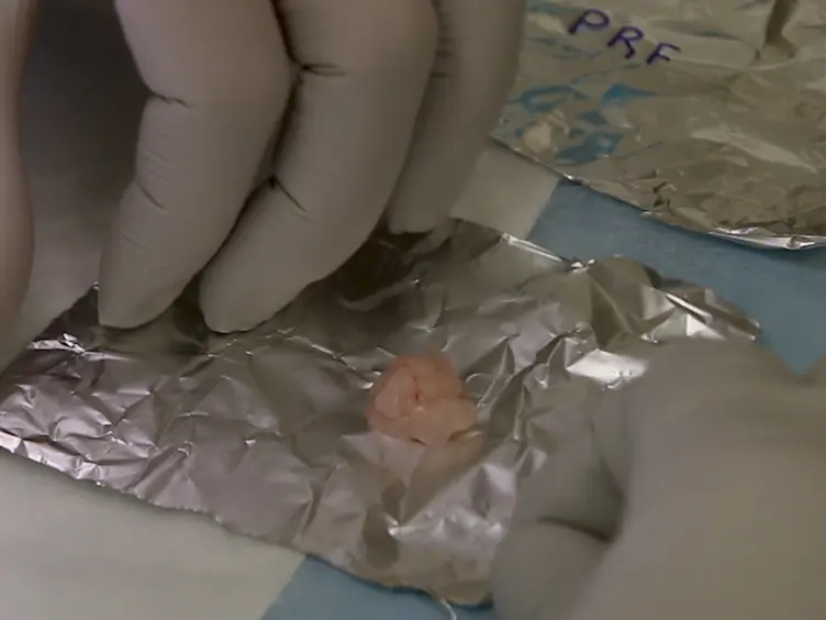 Mouse Adipose Tissue Collection and Processing for RNA Analysis
