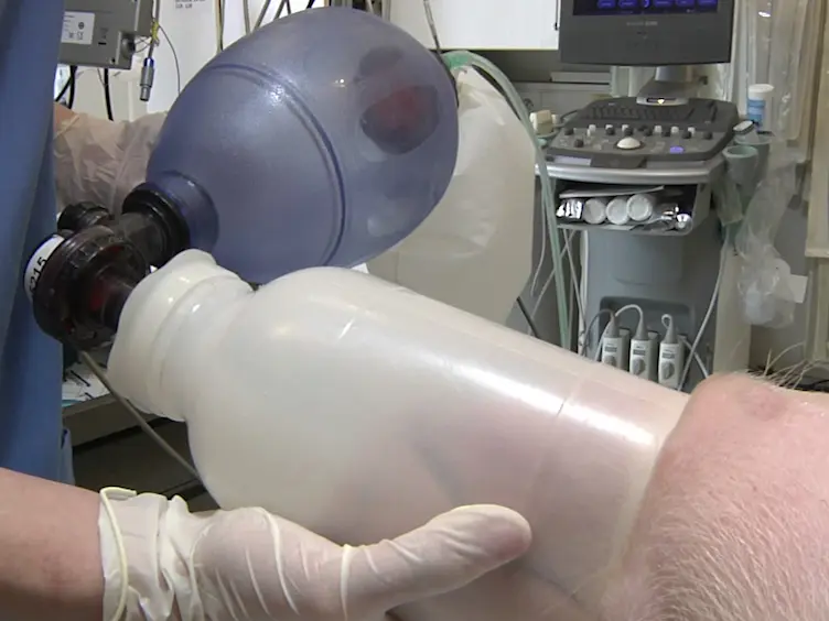 Tachycardia-Induced Cardiomyopathy As a Chronic Heart Failure Model in Swine