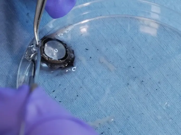 Simulating the Mechanics of Lens Accommodation via a Manual Lens Stretcher