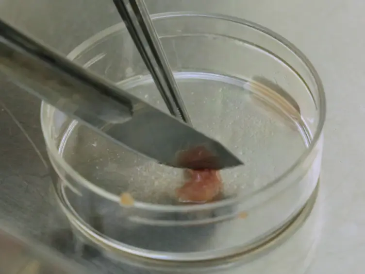 Isolation of Mesenchymal Stem Cells from Human Alveolar Periosteum and Effects of Vitamin D on Osteogenic Activity of Periosteum-derived Cells