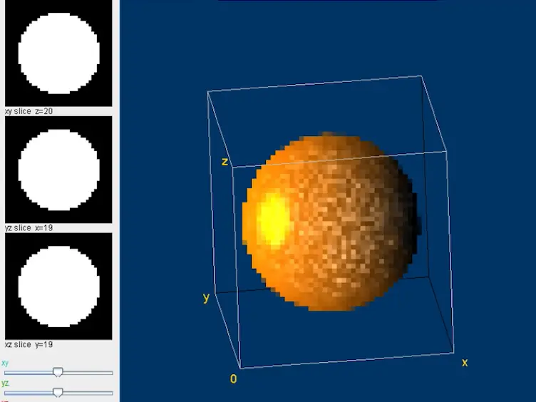 Outer-Boundary Assisted Segmentation and Quantification of Trabecular Bones by an Imagej Plugin