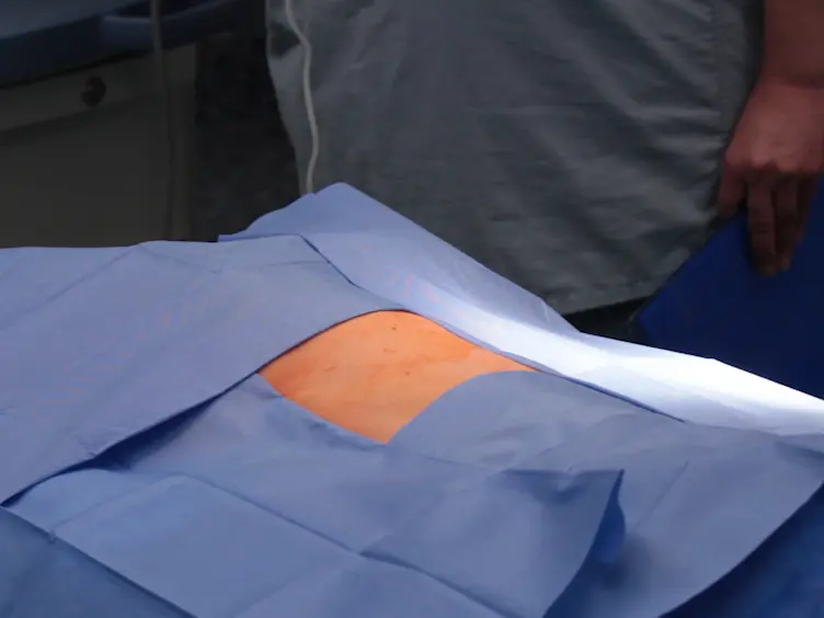 Surgical Swine Model of Chronic Cardiac Ischemia Treated by Off-Pump Coronary Artery Bypass Graft Surgery