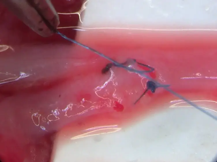A Rabbit Model of Durable Transgene Expression in Jugular Vein to Common Carotid Artery Interposition Grafts